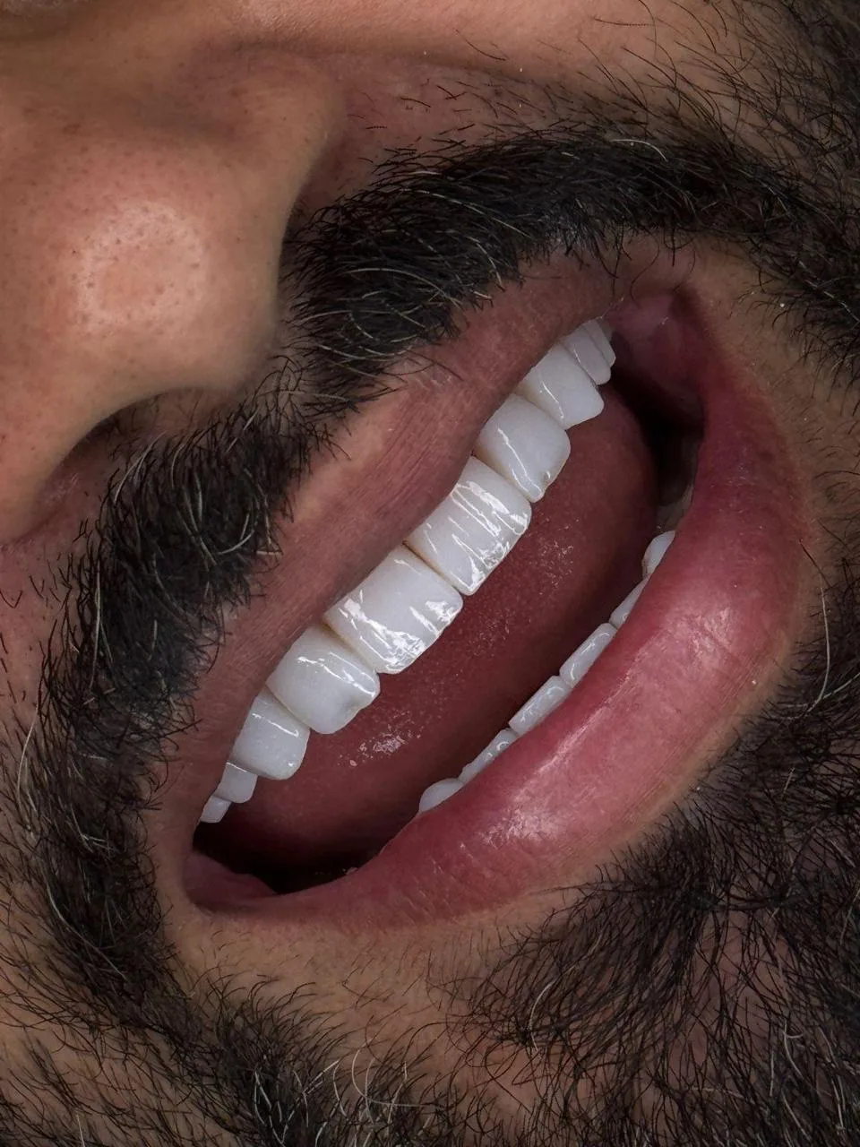 Sorriso masculino em destaque