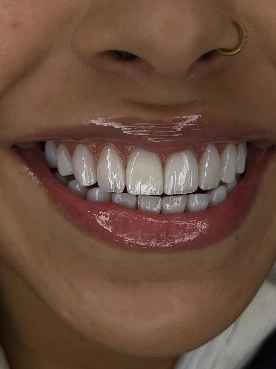 Sorriso feminino em destaque