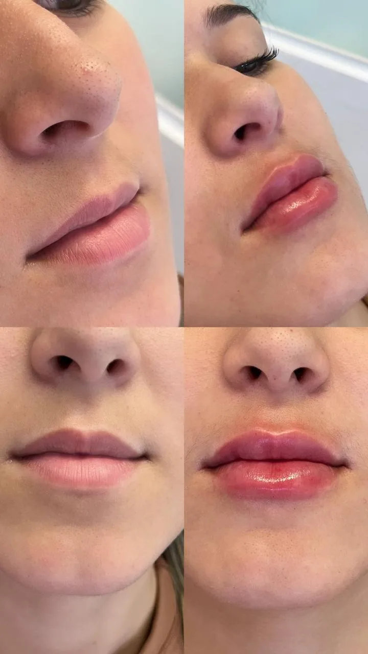 Comparativo de cuidado estético facial