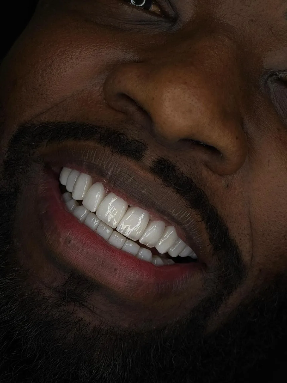 Sorriso masculino natural