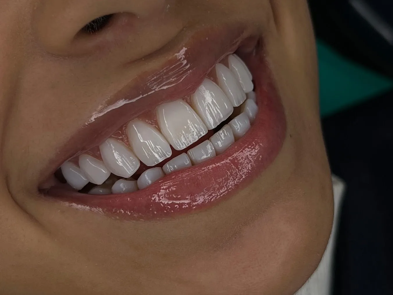 Detalhe de sorriso feminino