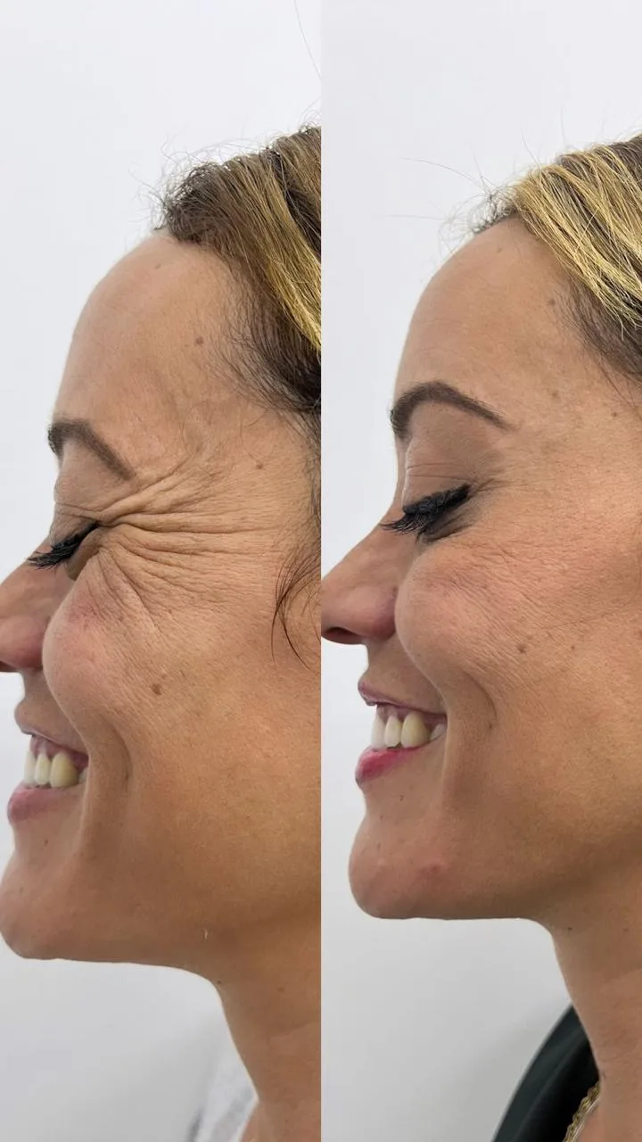Comparativo de cuidado facial
